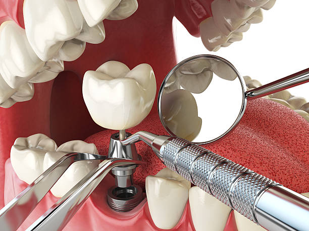 Best Emergency Care for Gum Disease in Falls Church, VA
